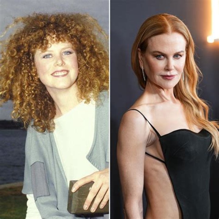Nicole Kidman: The Secret to Looking Younger