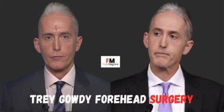 Trey Gowdy Nose Surgery: What You Need to Know